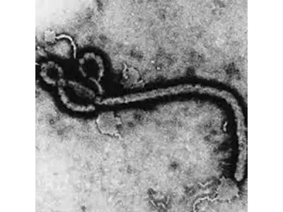 Key facts about Brazilian Hemorrhagic Fever you should know