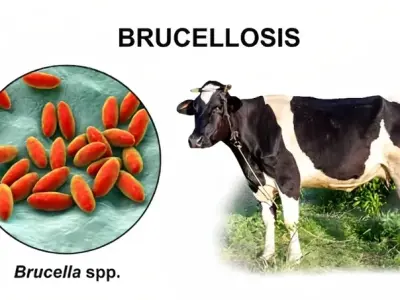 What is brucellosis? Treatment guide for infectious diseases