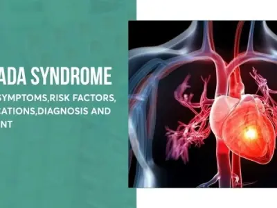 Brugada Syndrome risk factors you must know right now