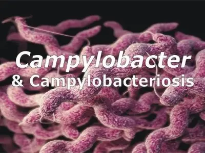 Campylobacteriosis - A common cause of food poisoning