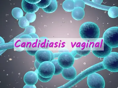 Candidiasis - A guide to yeast infections and thrush