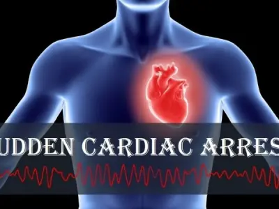 Cardiac arrest symptoms causes diagnosis and treatment