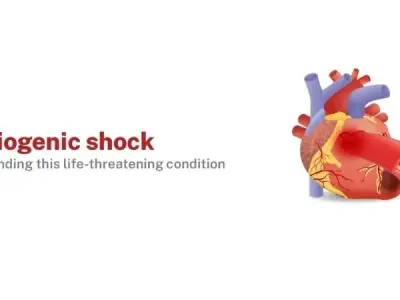 Cardiogenic shock symptoms causes and medical management