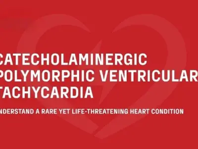 Catecholaminergic Polymorphic Ventricular Tachycardia