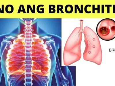 How to prevent infections and flare-ups of chronic bronchitis