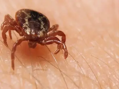 Colorado tick fever symptoms causes and treatment tips