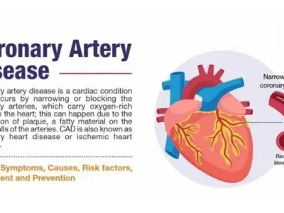 Coronary Artery Disease (CAD) overview symptoms prognosis