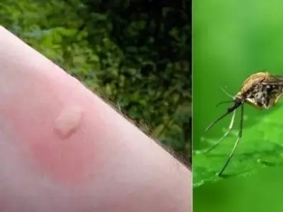 Protecting your family from dengue fever mosquitos