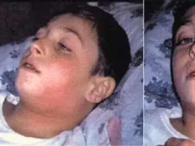 How diphtheria spreads and how to prevent it?