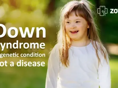 Down syndrome - Health considerations across the lifespan