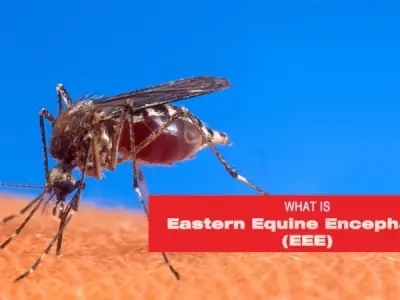 Understanding eastern equine encephalitis symptoms early