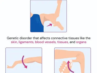 Managing the daily symptoms of Ehlers-Danlos syndromes