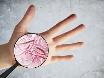 Effective topical treatments for persistent erythrasma