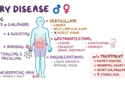 Fabry disease - A rare X-linked lysosomal storage disorder