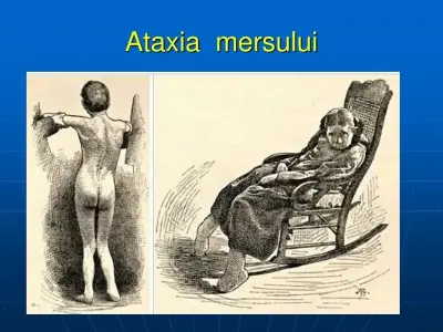 Understanding the genetic causes of friedreich's ataxia