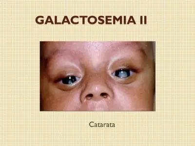 Galactosemia - A guide to symptoms and dietary management