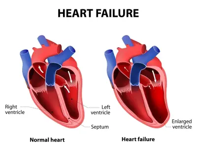 The difference between systolic and diastolic heart failure