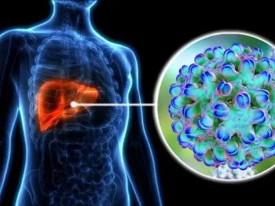 What is Hepatitis D - The link between hepatitis b and hepatitis D