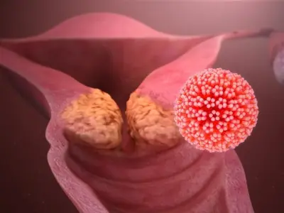 Understanding the human papillomavirus (HPV) infection