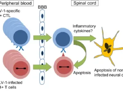 Understanding human T-lymphotropic virus (HTLV) infection