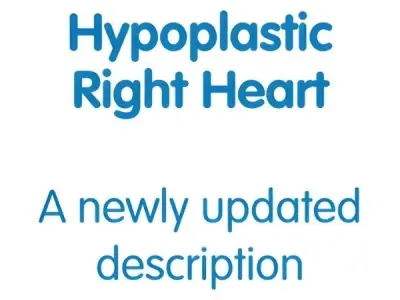 Hypoplastic Right Heart Syndrome (HRHS) management