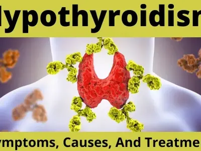 Hypothyroidism - Common signs of hypothyroidism