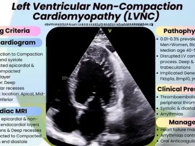Living With Left Ventricular Non-compaction Cardiomyopathy