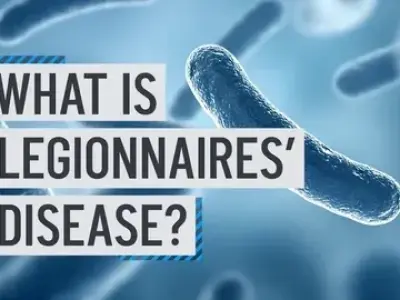 Understanding legionellosis - Signs of disease