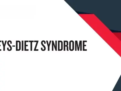 Loeys-Dietz syndrome overview causes and prevention tips