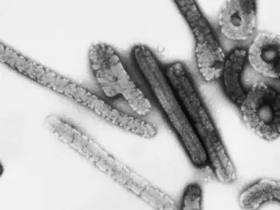Marburg virus disease - What you need to know?