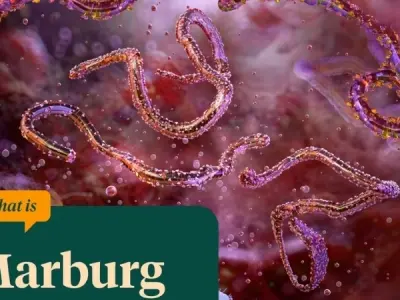 Understanding marburg virus disease symptoms and risks