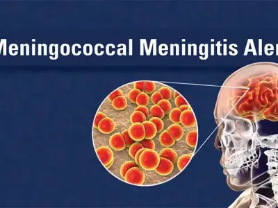 Meningococcal disease - How to spot a medical emergency