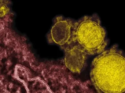 MERS - Understanding middle east respiratory syndrome