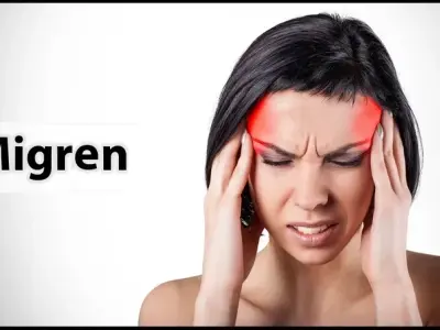 Migraine relief - Proven pain reliever