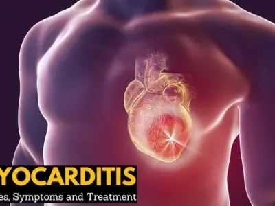 Myocarditis - Recognizing early symptoms