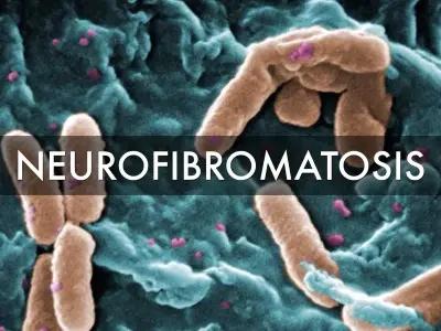 Neurofibromatosis - Understanding NF1, NF2, and schwannomatosis