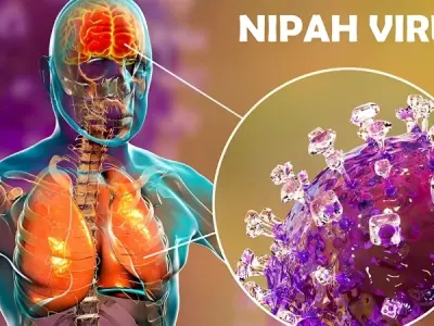 Nipah virus encephalitis causes symptoms and prevention