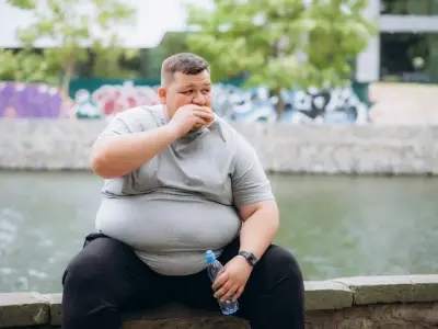 Obesity - Understanding it as a complex chronic disease