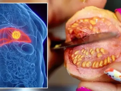 Recognizing the vague symptoms of ovarian cancer