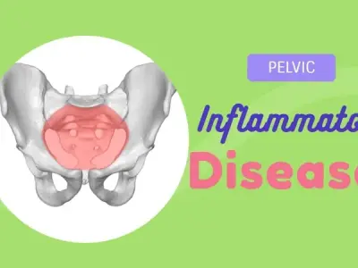 Pelvic inflammatory disease (pid) - What you need to know