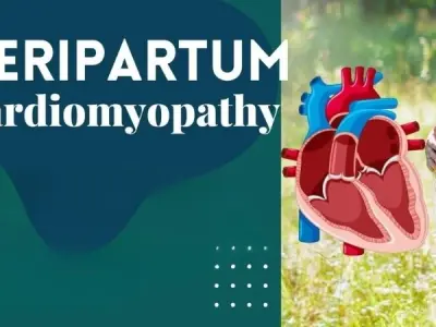 Peripartum (Postpartum) Cardiomyopathy symptoms explained