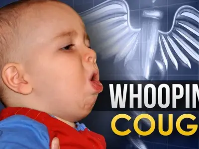 What is whooping cough? Pertussis overview