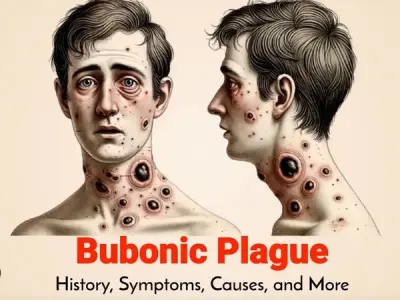 How the septicemic plague spreads to humans?