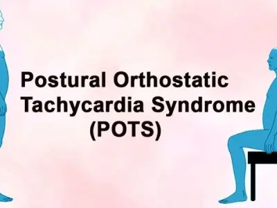 Postural Orthostatic Tachycardia Syndrome (POTS) overview