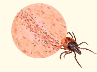 How powassan virus disease can transmit in just minutes