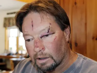 Rabies - Causes, symptoms and essential prevention tips