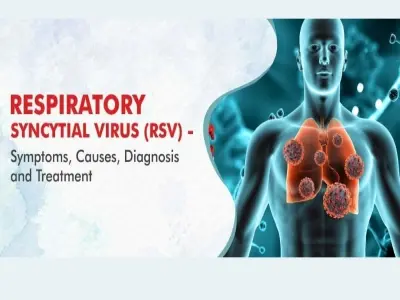 Understanding respiratory syncytial virus (RSV) infection