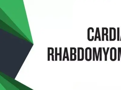 Rhabdomyoma key signs diagnosis and medical solutions