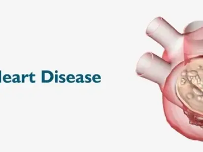 Spot rheumatic heart disease symptoms early for better health