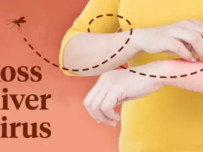 How to avoid ross river fever while traveling in Australia